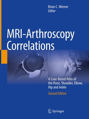cover image of MRI-Arthroscopy Correlations